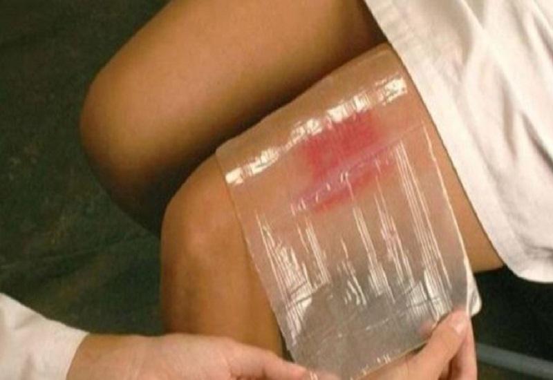 علماء يبتكرون مادة شبيهة بالجلد تعالج الجروح بشكل كامل خلال 24 ساعة